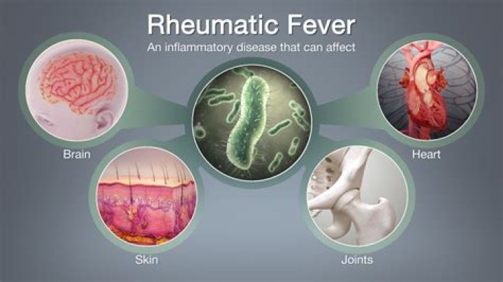 Can rheumatic fever cause permanent joint damage