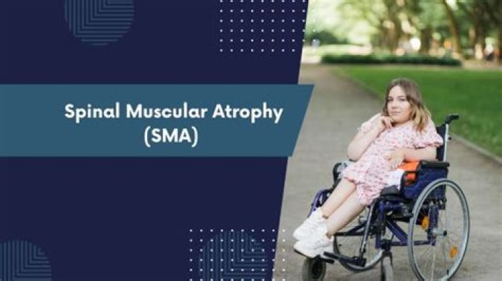 Can you die from spinal muscular atrophy