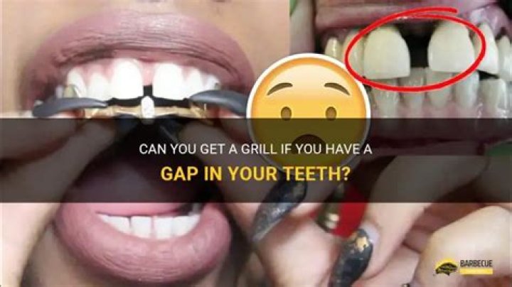 Can you get a grill if you have a gap