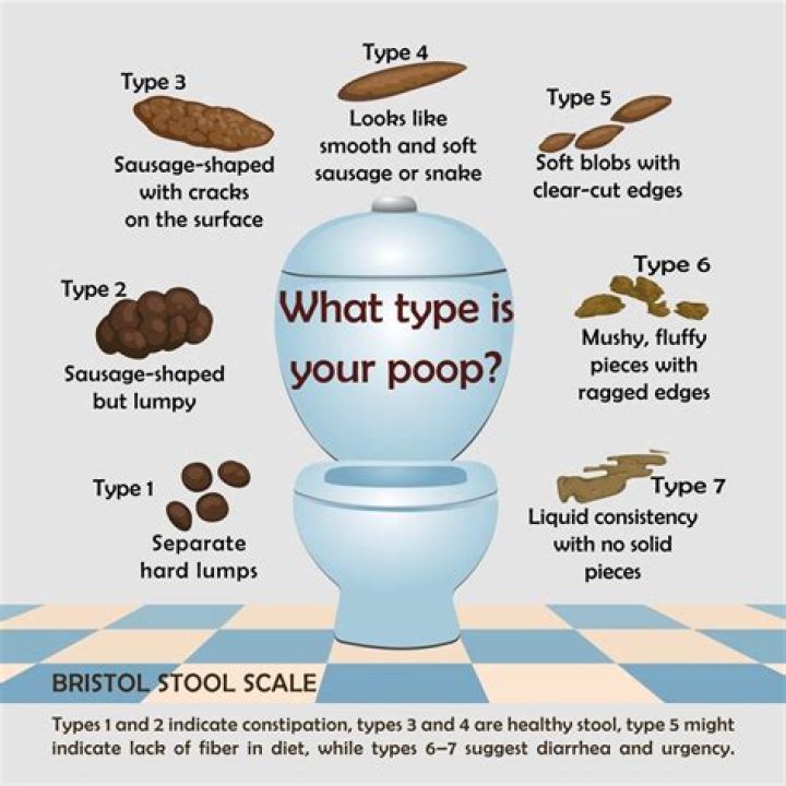 Can you poop when you have an ileostomy