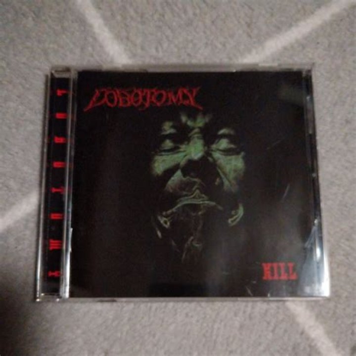 Does a lobotomy kill you