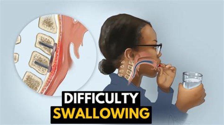 Does HIV cause difficulty swallowing