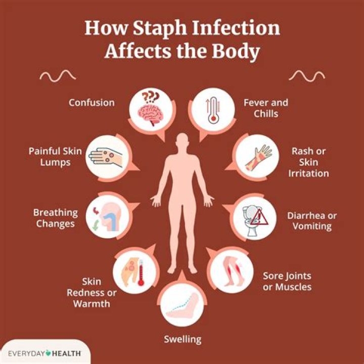 How do you know if you have a staph infection after surgery