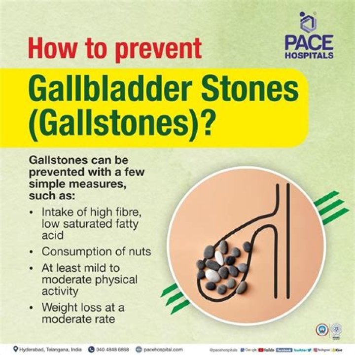 How do you prevent gallstones after gastric bypass