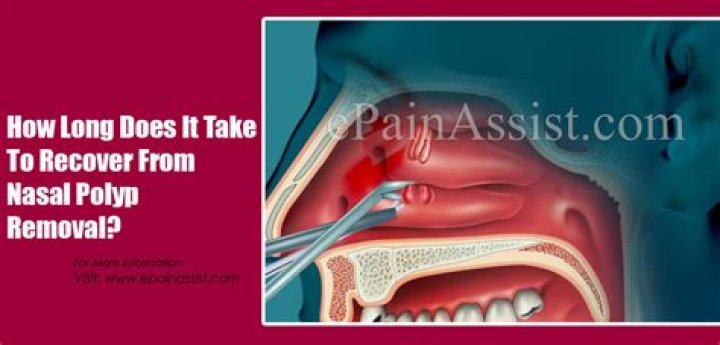 How long does it take to recover from cervical polyp removal