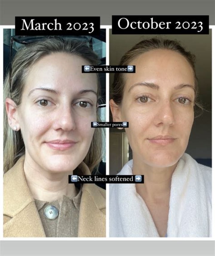 How often can you use clindesse