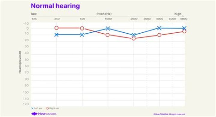 Is hearing humming normal?