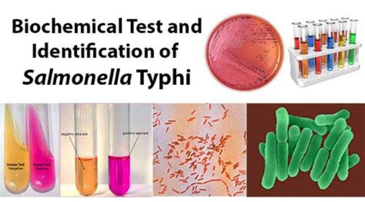 Is Salmonella typhimurium urease positive