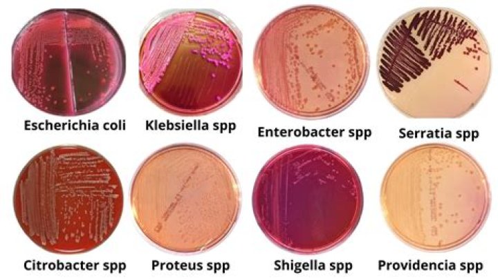 Is Shigella flexneri catalase positive or negative
