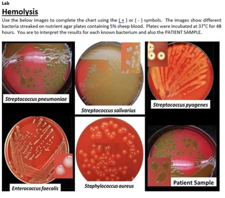 Is Staphylococcus beta hemolytic