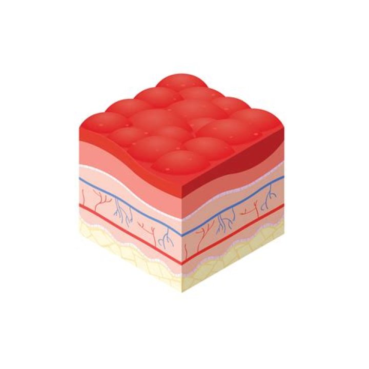 Was ist eine granulierende Wunde