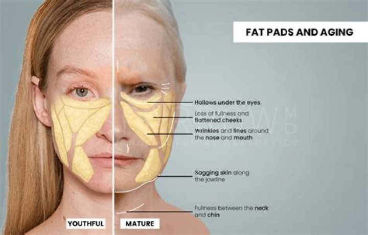 What causes face to get fatter