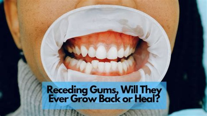 What do the numbers mean when they check your gums