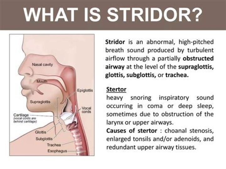 What does stridor sound like in toddler