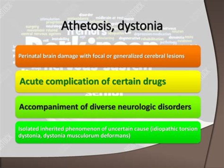 What drugs cause acute dystonia