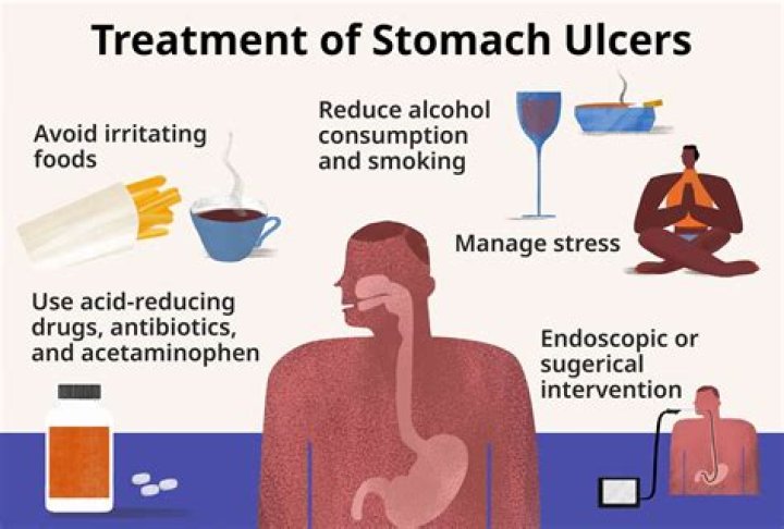 What is the best prescription drug for stomach ulcers