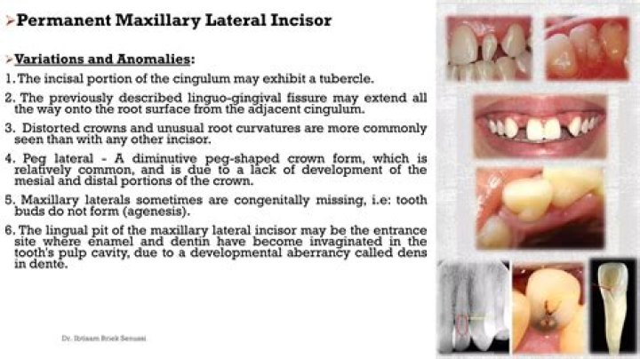 What is the general eruption date for the permanent maxillary lateral incisor