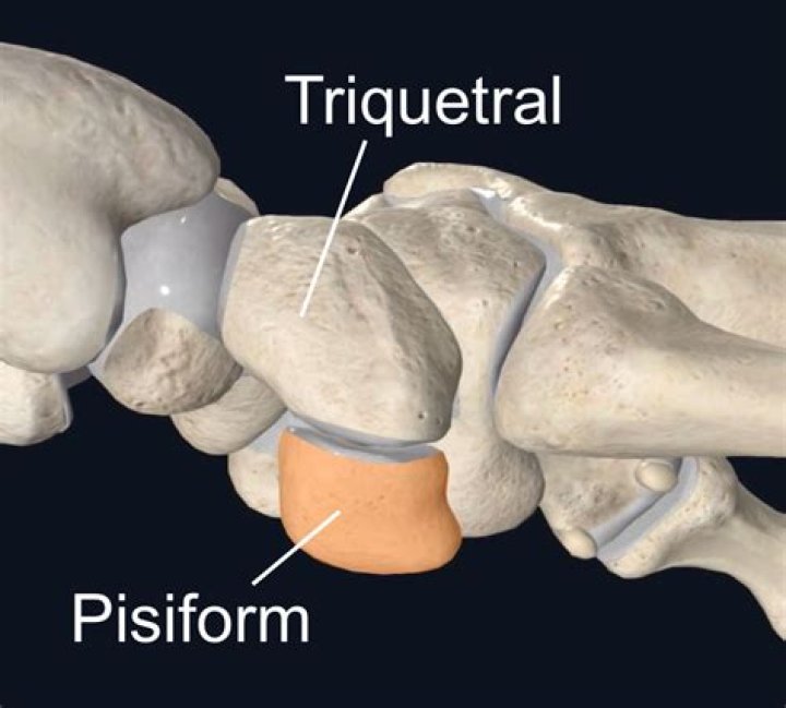 What is the Pisotriquetral joint