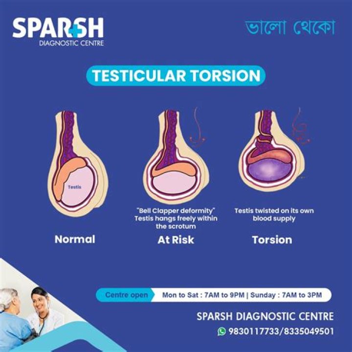 What is torsion medical term