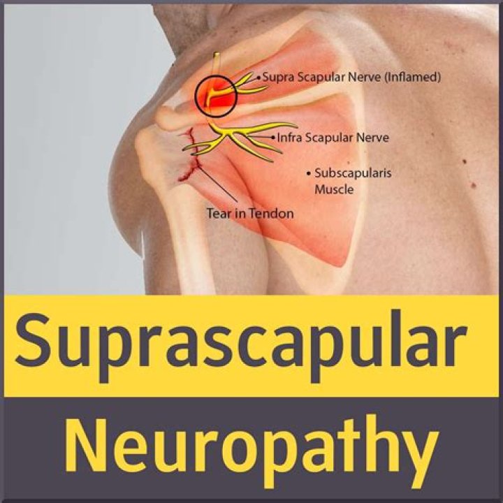 What muscles does the Suprascapular nerve innervate
