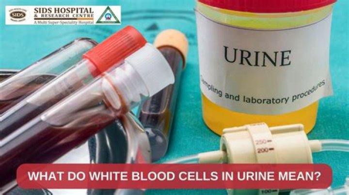 What tests are done for salmonella