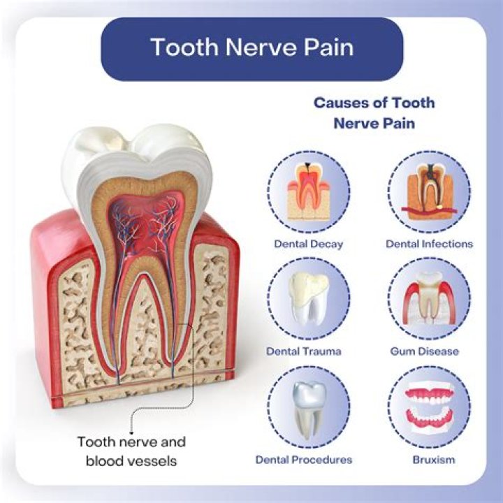 Which disorder is the most common cause of dental pain