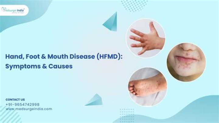 Why do I keep getting hand foot and mouth disease